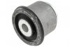 TULEJA WAHACZA PRZEDNIEGO GÓRNEGO ZTP-CH-019D JEEP GRAND CHEROKEE WK2 DODGE DURANGO WD 2011-2015